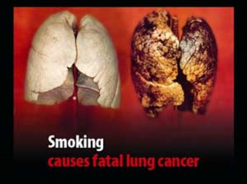 lung cancer causes other than smoking Lung quit prevent smoking cancer ...