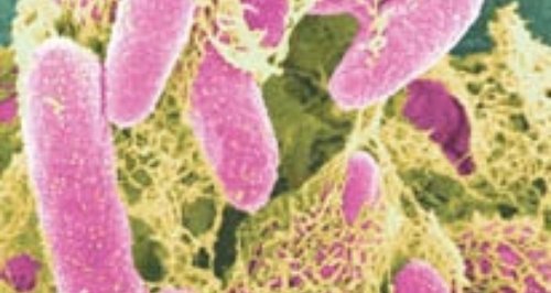E-coli in colour