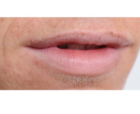 Guess the hot lips