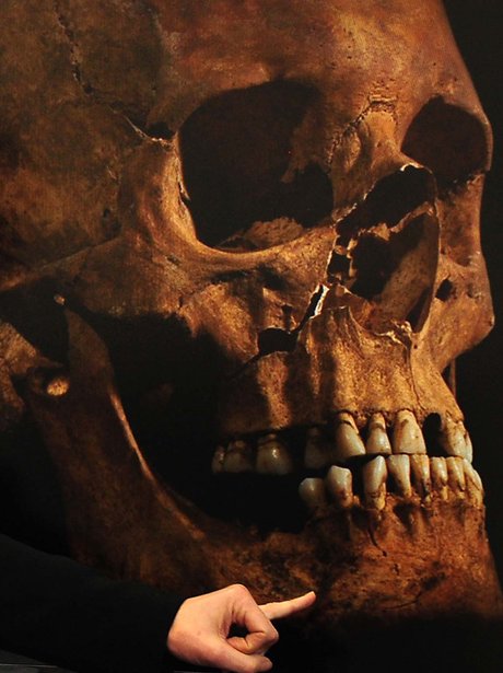 Skeleton skull of Richard III