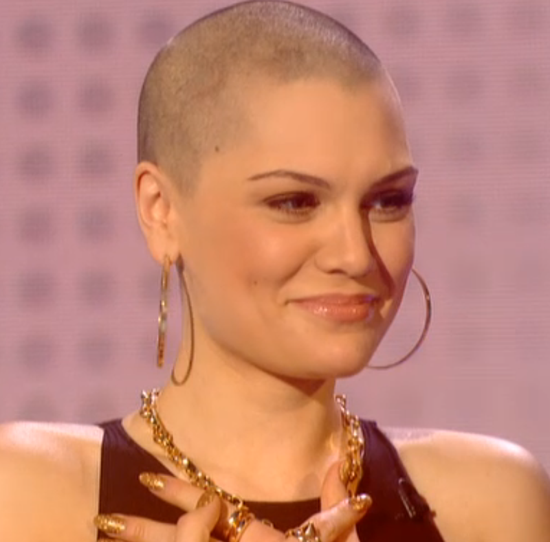 Лысая певица. Jessie j лысая. Валерия певица лысая. Jessie j Shaved. Слава 2007 певица лысая.