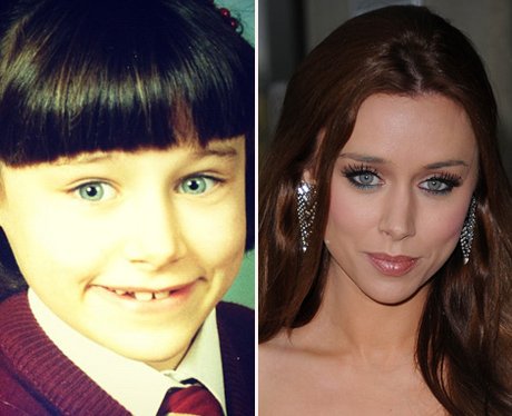 Una Healy: Then and Now