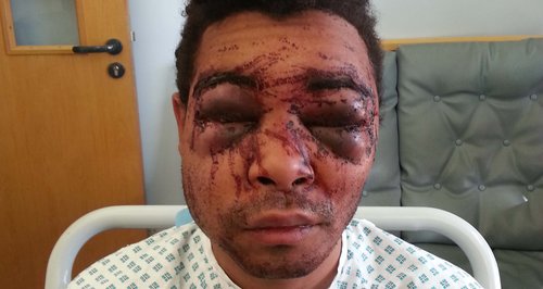 Swindon robbery victim