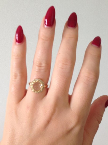 Kimberley Walsh's Engagement Ring