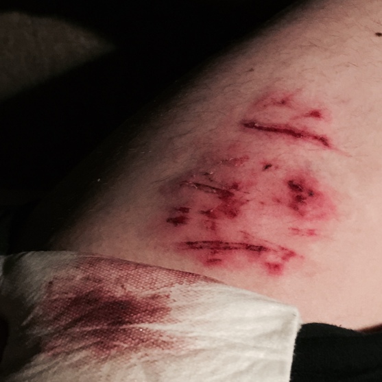 Wimborne firework assault injury