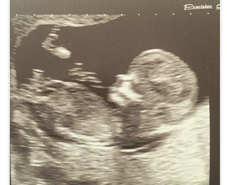 A baby sonogram