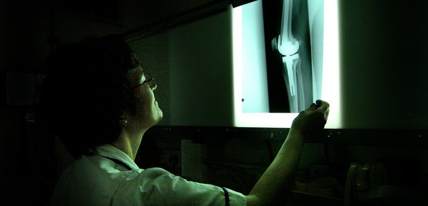 X-ray