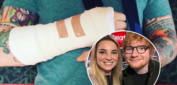 Ed Sheeran and Sian Broken Arm Assett