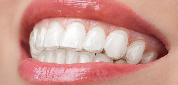 Brighton Implant Clinic