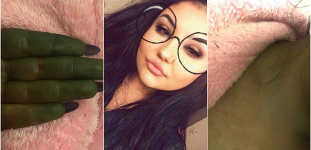 Fake tan turns woman green leaving her 'looking like Fiona from