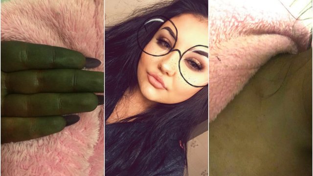 St Moriz fake tan leaves girl 'looking like Shrek