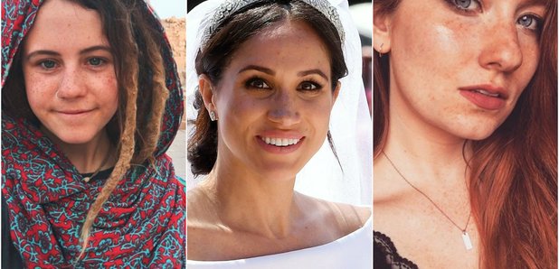 meghan markle freckles