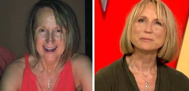 Carol McGiffin shows off the results of her secret face lift on Loose ...