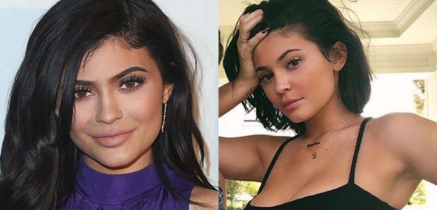 Kylie Jenner reveals she has had all her lip fillers removed