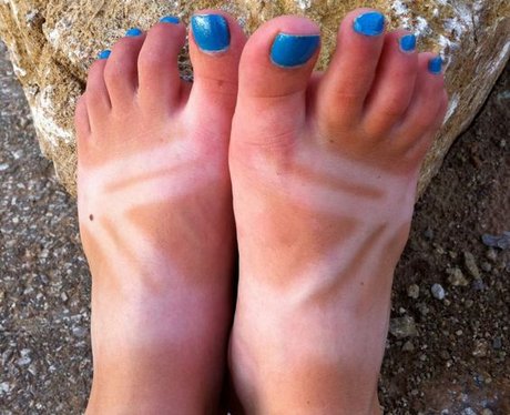 suntan fails