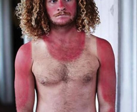 suntan fails