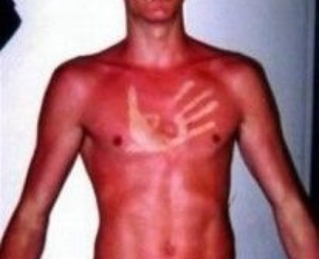 suntan fails