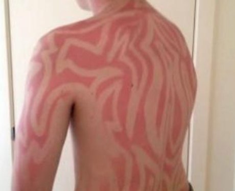suntan fails