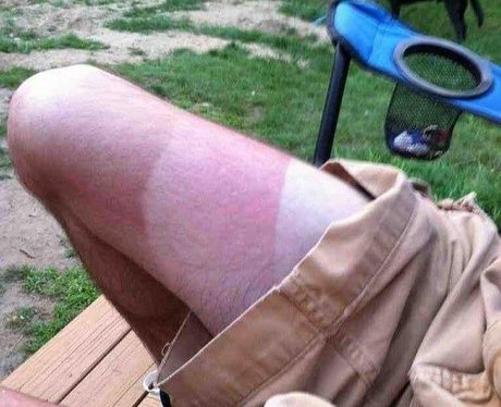 suntan fails