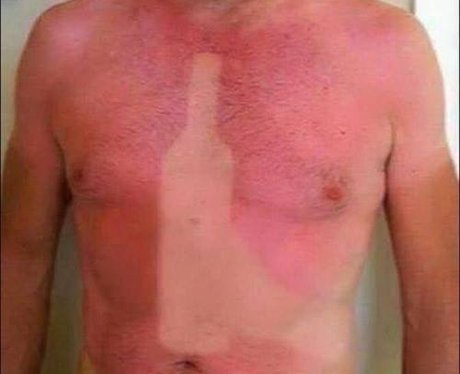 suntan fails