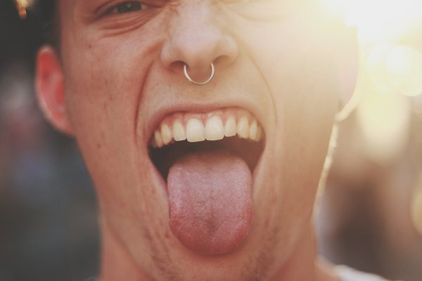 healthy tongue colour